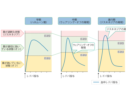 ウェア リング オフ