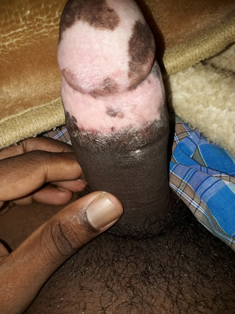 GowriR18's tweet photo. Enga amma night enthirchi en sunni ya paakura https://t.co/cyqgP6weVp