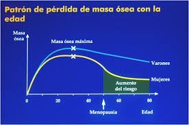 Tanto los hombres como las mujeres sufren pérdida ósea a medida que envejecen. El adulto tiene que ser consciente de las medidas que debe tomar para hacer más lento el proceso natural de pérdida ósea.