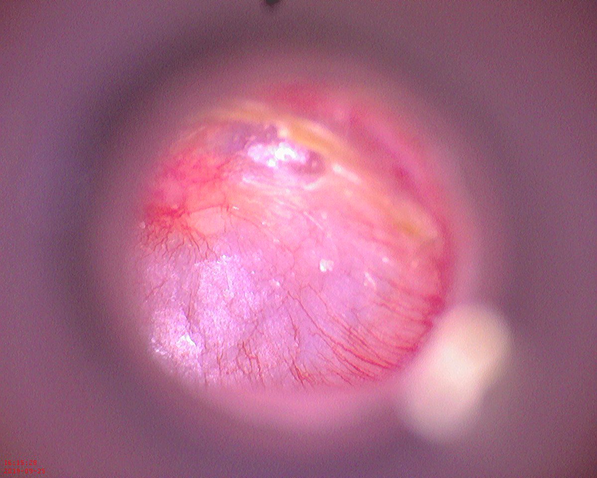 Dr Jean-Jacques Fraslin tweet media