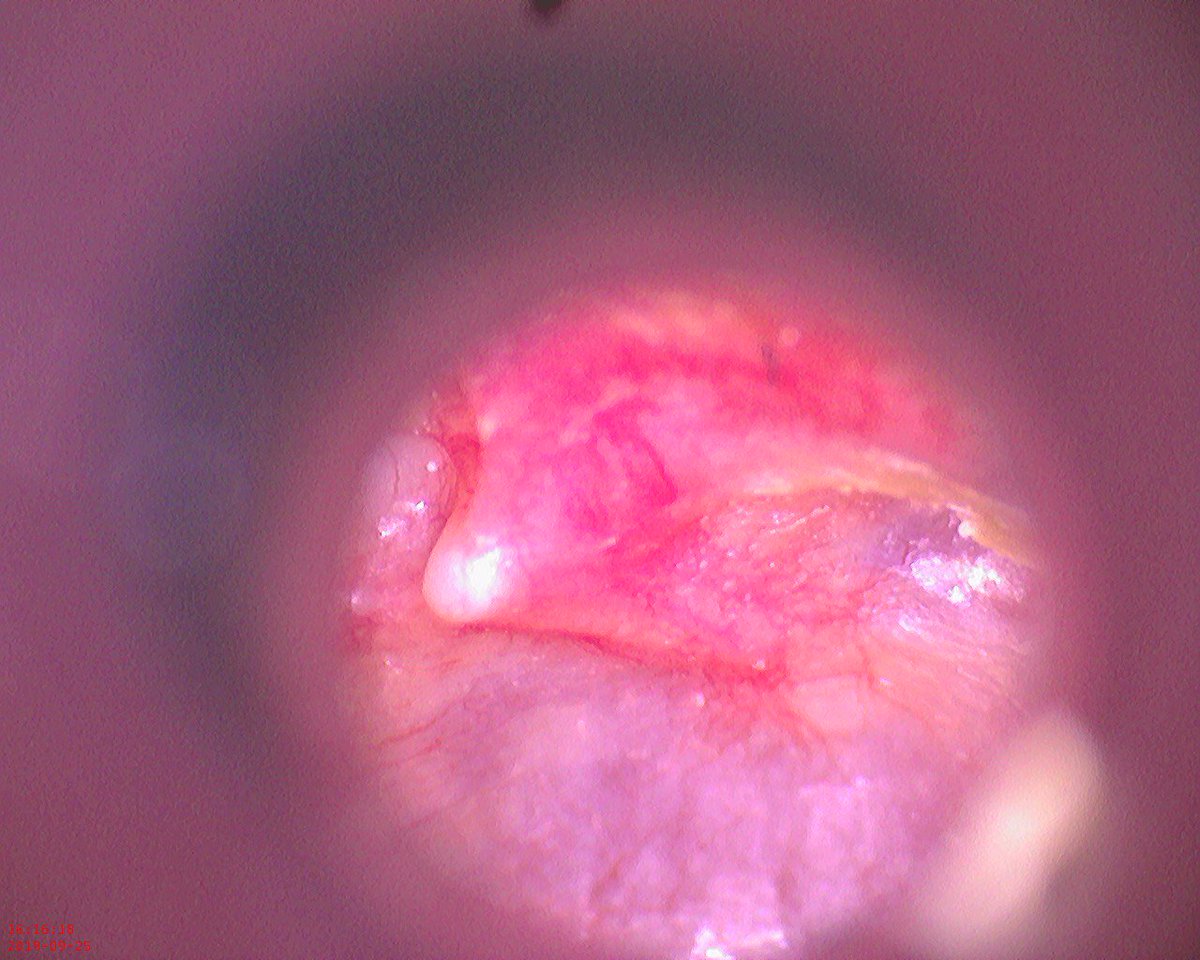 Dr Jean-Jacques Fraslin tweet media