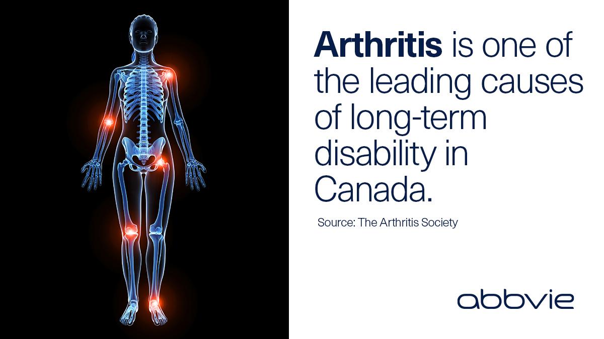 AbbVie Canada tweet media