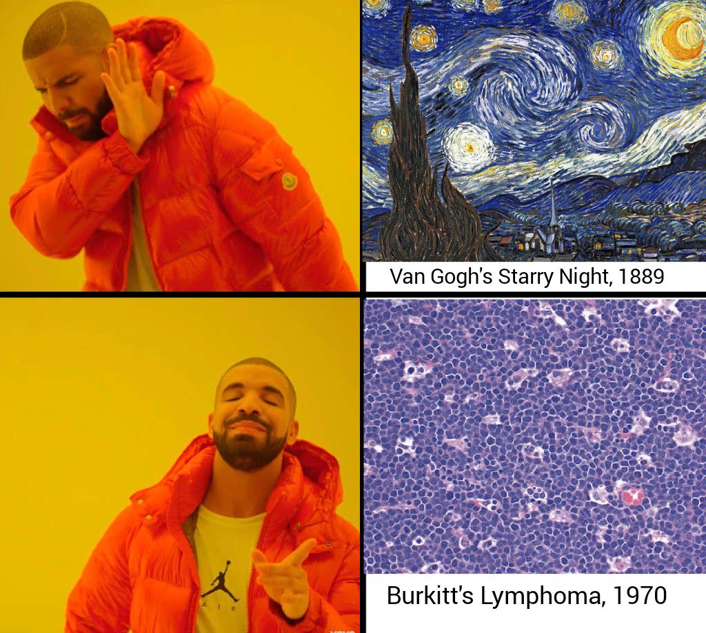 JonLaiMD's tweet photo. Pathologist's version is just as #cool. #pathologymemes #somanyanologies #vangogh #starrynight #Burkitt #pathologyhistory #art #drake https://t.co/OqFzK1IkM2