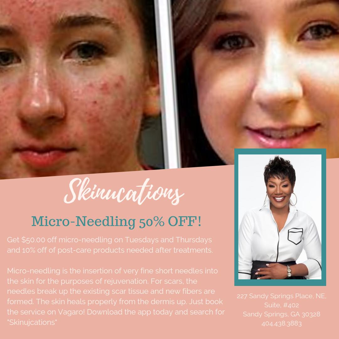 Skinucations's tweet photo. Get 50% Micro-Needling and 10% off of post-care products! Just download Vagaro and make an appointment. #Sales  #services  #beauty  #facial https://t.co/Un3RBsvxY4