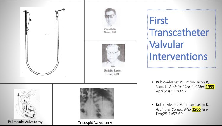 Quick Interventional Cardiology History Note:

The 1st Transcatheter Cardiac Intervention #TCT ever: 

Pulmonary Valvulotomy (1953).
Drs. Limon, Rubio &amp; Soni. 

Proud founders of #INC_CathLab. 

Thanks to P. Loyalka MD
#TCT2019 #CardioTwitter <a href="/crfheart/">Cardiovascular Research Foundation</a> <a href="/TCTMD/">TCTMD</a> <a href="/TCTConference/">TCT Conference</a>