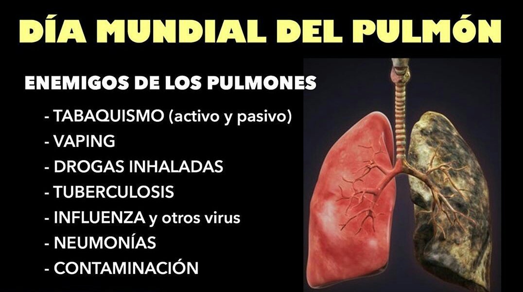 Hoy es el #DíaMundialdelPulmón. Elige salud: consulta a tu médico, decide dejar de fumar ya y ayuda a alguien a dejar de fumar; camina u trabaja para reducir la contaminación ambiental. La salud de tus pulmones está en tus manos.
