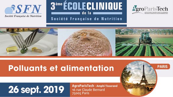 M2_NutriSante's tweet photo. Aujourd'hui, dans le cadre de leur emploi du temps, nos étudiants se rendent à Paris pour la 3ème école clinique de la @SFNutrition_Fr. Au programme, conférences sur le thème : « Polluants et alimentation » #toxicologie #alimentation https://t.co/SM8dEgAlYm