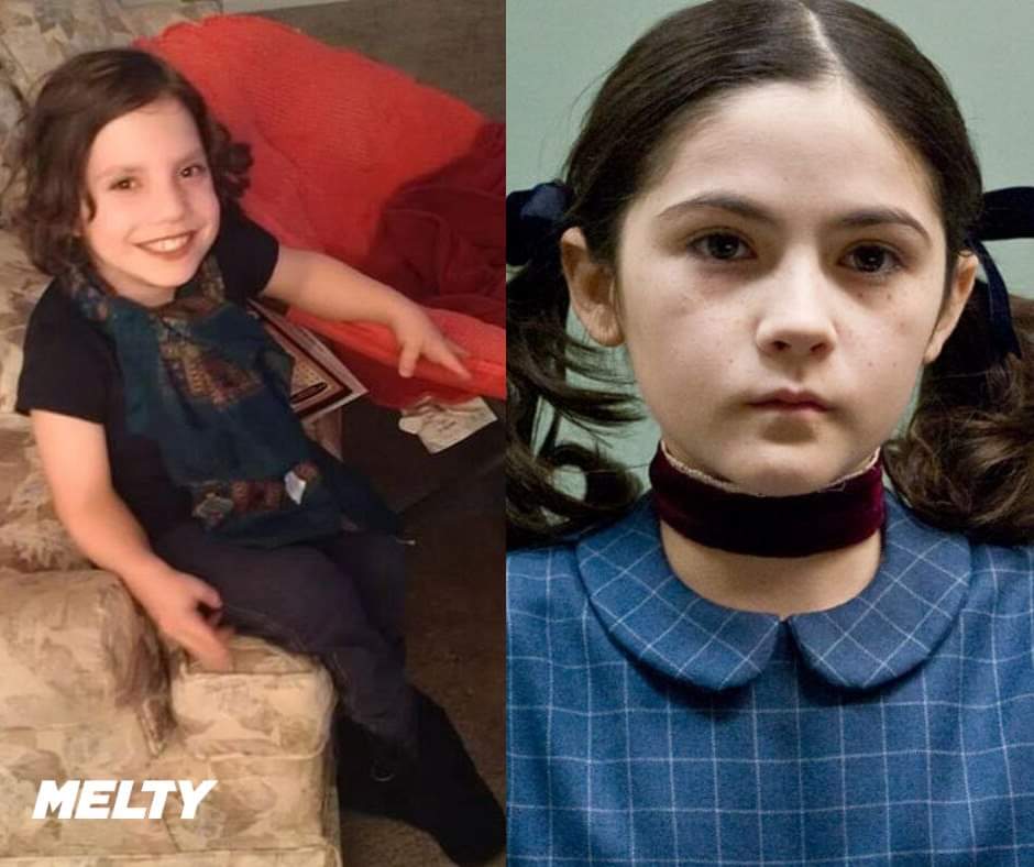 piquelesyeux's tweet photo. Ingrid a commencé très jeune
Un couple américain a adopté la petite Natalia  pensant qu'elle avait 8 ans. En réalité la jeune fille atteinte de nanisme en avait 22 et souffrirait d'une maladie mentale qui l'a poussé à tenter de tuer plusieurs fois ses parents adoptifs... https://t.co/2fsPxuGhot