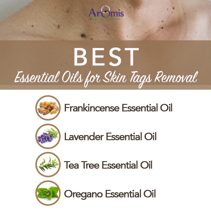 Autonom Diktere Rede ArOmis Aromatherapy on X: "By using essential oils, you can remove skin tags. There are different essential oils that have proven to be quite an effective remedy for skin tags. Discover the Autonom Diktere Rede ArOmis Aromatherapy on X: "By using essential oils, you can remove skin tags. There are different essential oils that have proven to be quite an effective remedy for skin tags. Discover the
