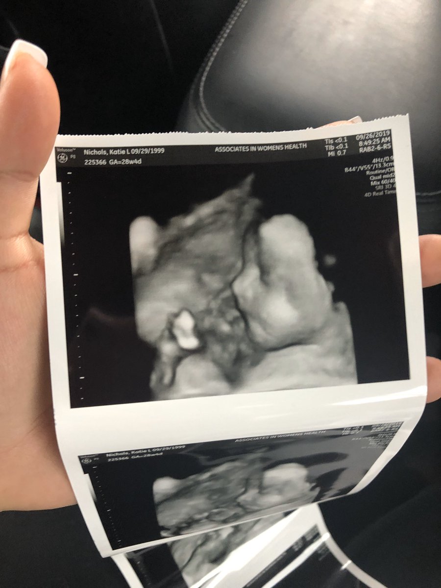 Katiebugg444's tweet photo. She’s almost here! 😍😫 I cant wait!! @koolio_kyle AHHHH💙 https://t.co/KZ34TfMse9