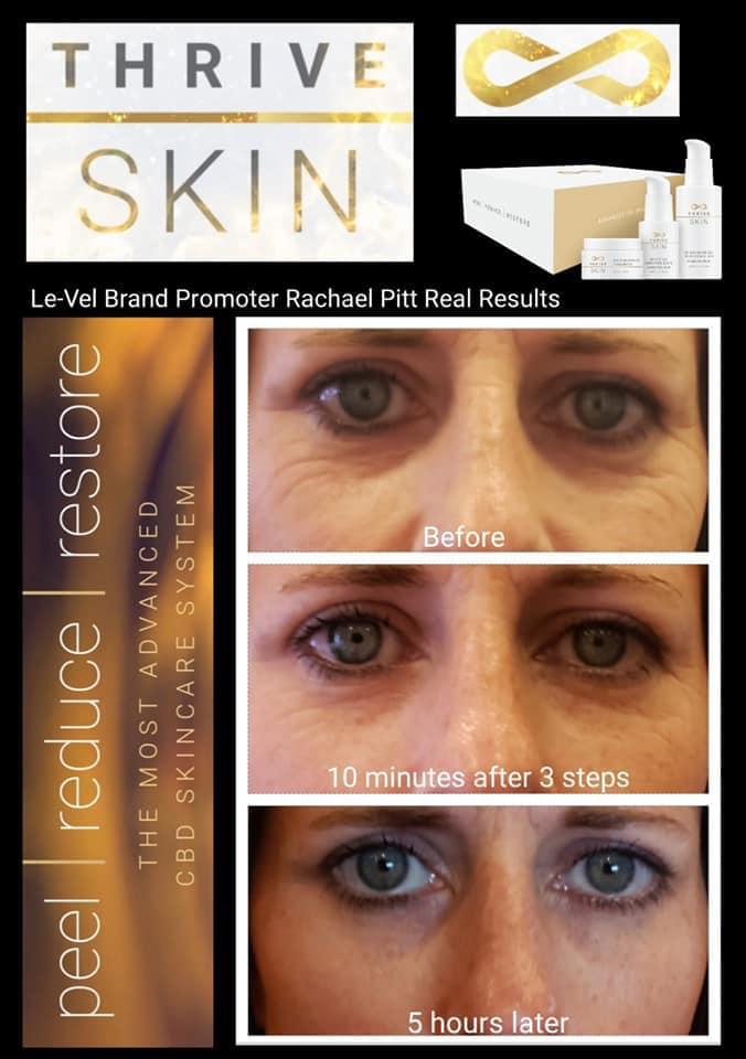 DilanzoAl's tweet photo. Are you barely getting through the day? Are you ready to change your life inside and out? Are you ready to THRIVE? Join the movement that everyone is talking about! Thrive is innovative nutrition for your body.
Find out more, message me! 
#skincare #livingmybestlife https://t.co/YzaG2dWEwj