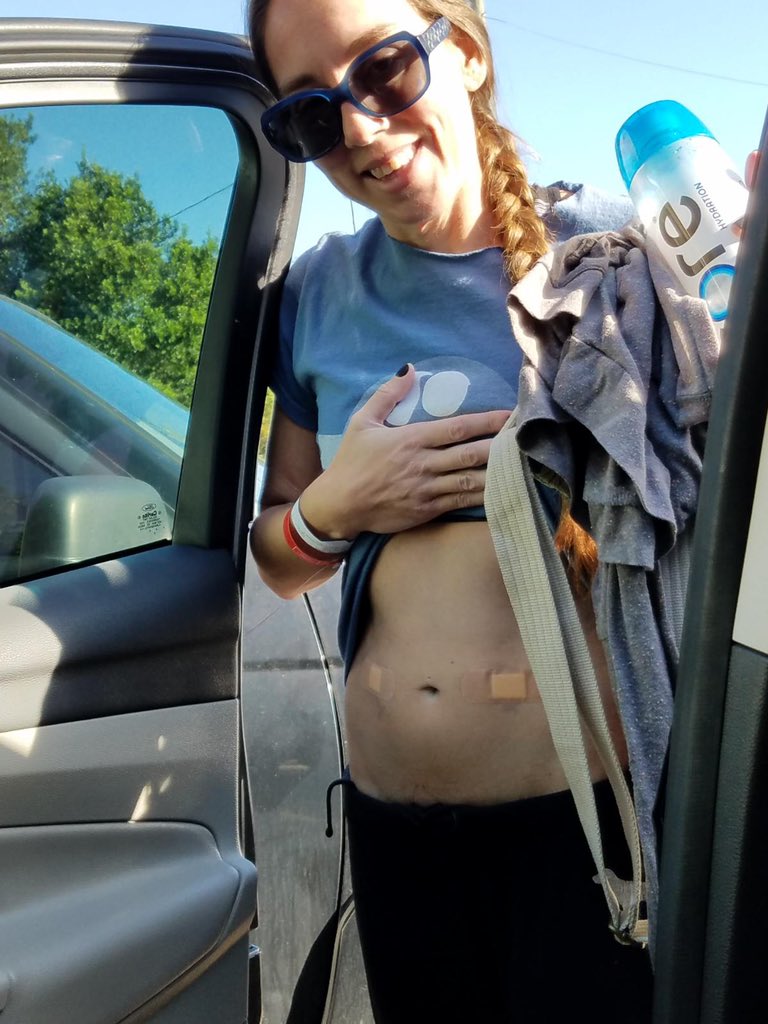 smanna750's tweet image. More photos from mom 😂. I enjoy sharing my journey, this allows me to see and show what I do not remember or can’t capture myself. #TAPblock #CPP #Gastroparesis