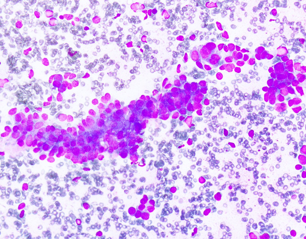 Ami Patel tweet media