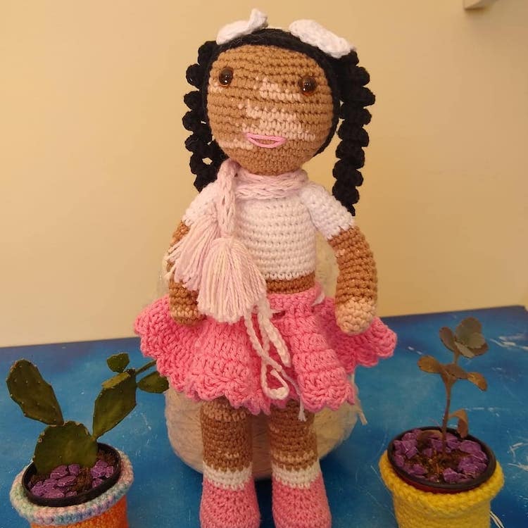 mymodernmet's tweet photo. Grandpa with vitiligo crochets dolls with same skin condition to give kids self-esteem. https://t.co/Svx8TBekNN https://t.co/RCqZMZFtnQ