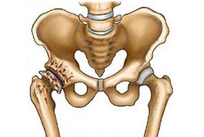 JournBoneres's tweet photo. Coxarthrosis; Post-isometric; Rehabilitation
#journalofboneresearch #bones #research
#submityourarticle @ https://t.co/a50eUpIP6N
https://t.co/rtrXcCuUWz https://t.co/ZV7Dqip5Jf