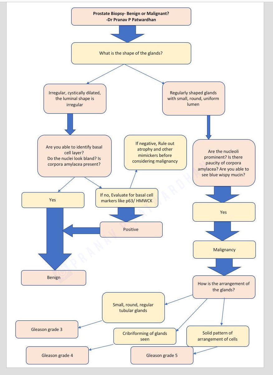 pranavp01's tweet image. What is your approach to the evaluation of a prostate biopsy? #Pathology #Education                           Thanks to @GladellPaner sir for reviewing this algorithm and for his valuable suggestions!