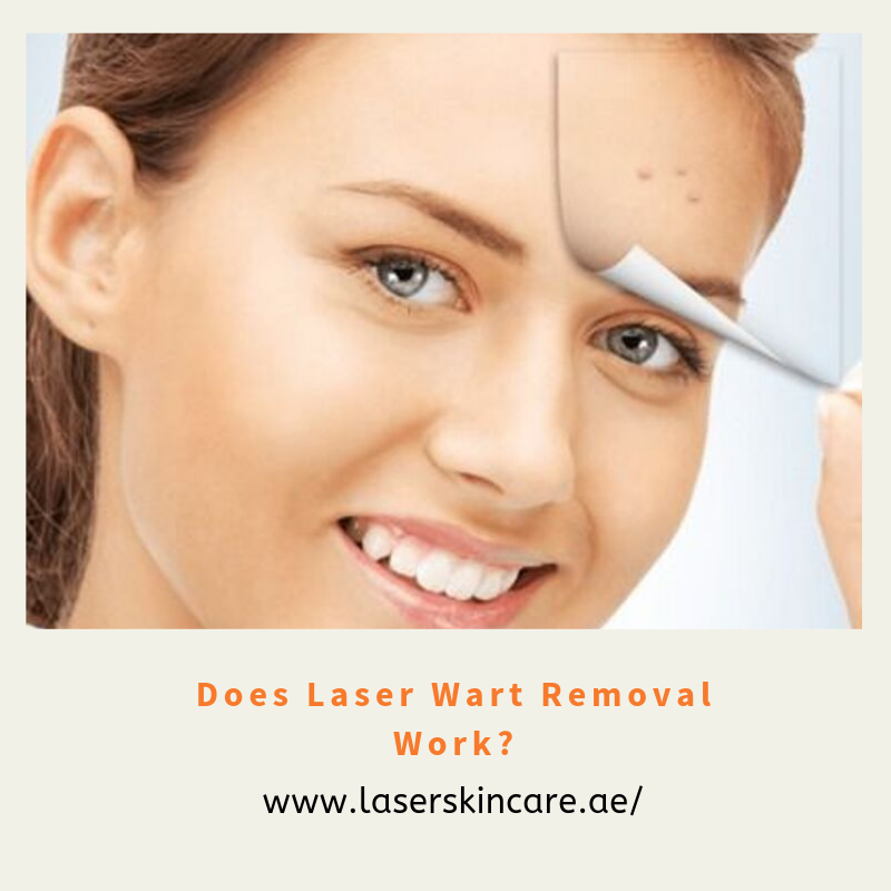 MominaSusan's tweet photo. Does Laser Wart Removal Work?
https://t.co/3uYA7yhJgP
#laserwartsremoval #wartsremoval #dubai #abudhabi #laserskincare #skincare #JusticeForHaleema #PMIKworldLeader #QandeelBaloch #UNGA2019 https://t.co/NW0Fx6OaOq