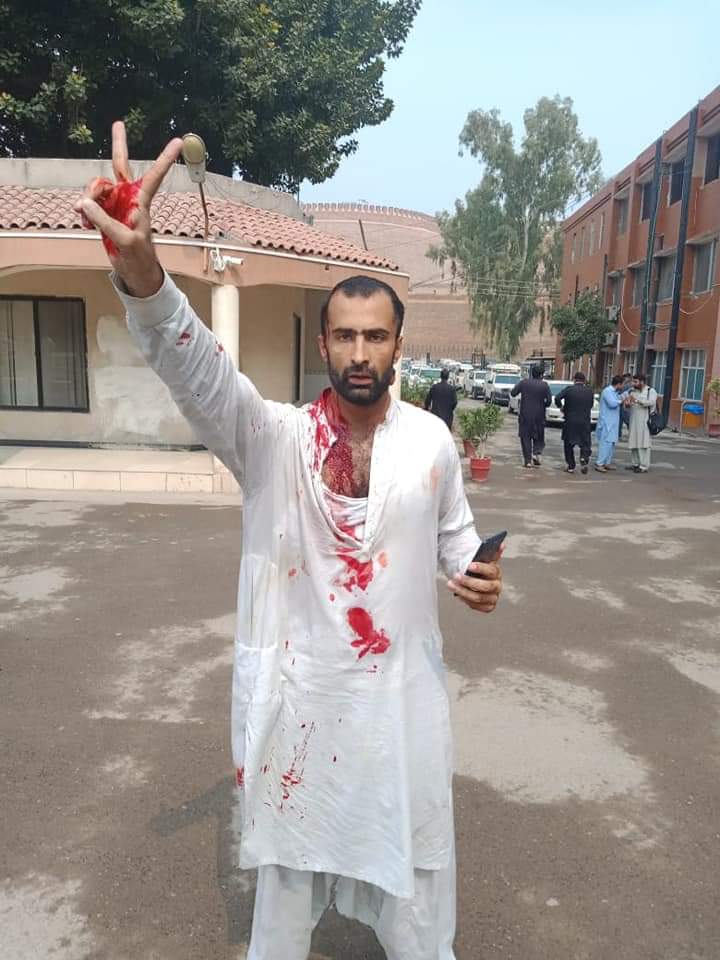 MJibranNasir's tweet photo. Will any representative from the Provincial Govt of KP take responsibility on brutal assault of doctors and staff including both male and female at #LadyReading Hospital as well as media reporters. Such actions by police show contempt of political administration for protestors https://t.co/oFhOPWjtmA