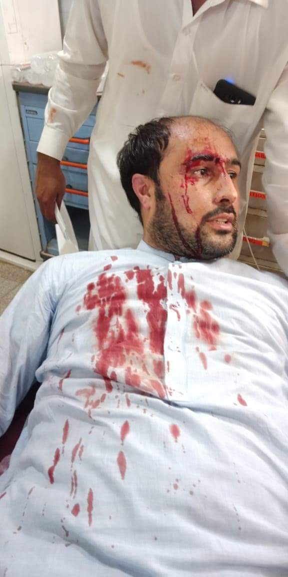MJibranNasir's tweet photo. Will any representative from the Provincial Govt of KP take responsibility on brutal assault of doctors and staff including both male and female at #LadyReading Hospital as well as media reporters. Such actions by police show contempt of political administration for protestors https://t.co/oFhOPWjtmA