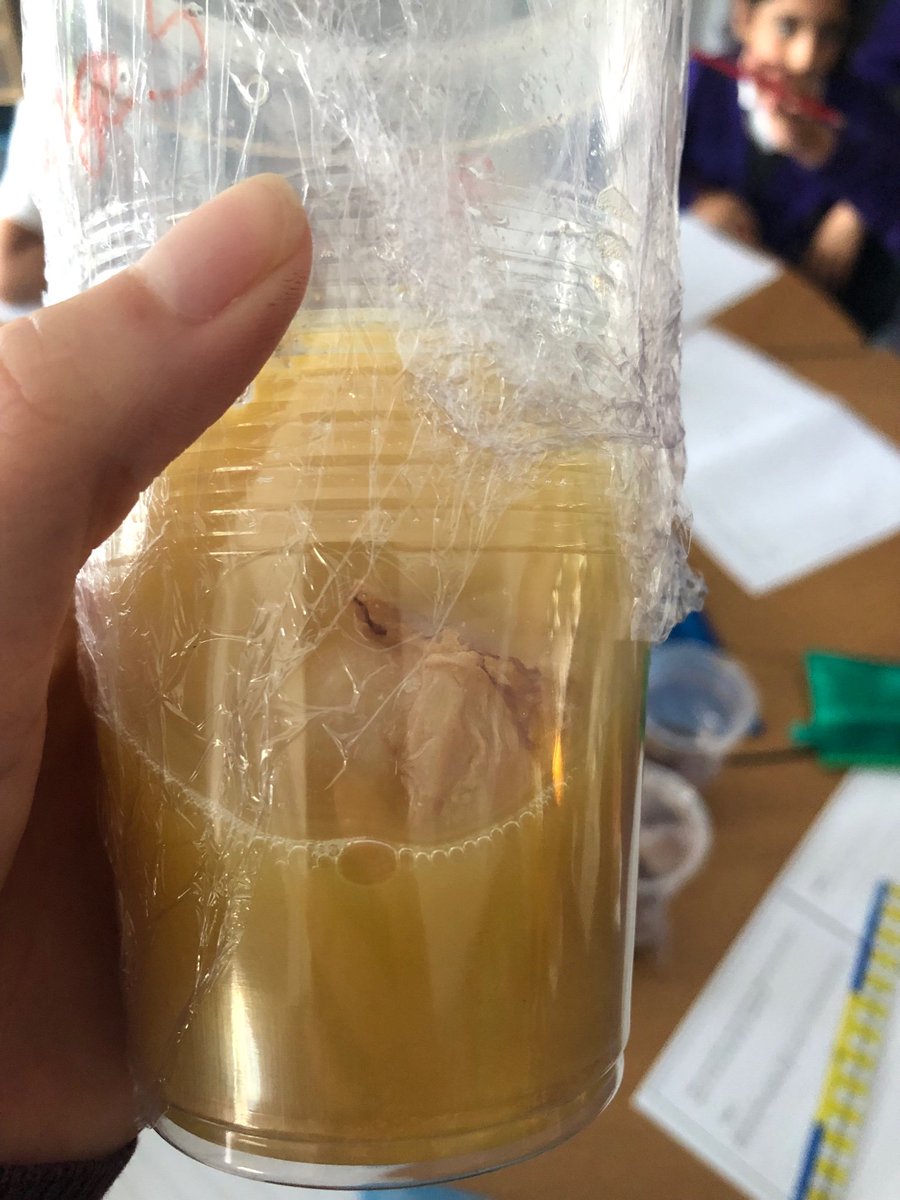 Week 1 of our eggsperiment and Year 4 do NOT recommend drinking energy drinks. The egg shell contains the same compounds as the enamel on our teeth! 🤮 #eggsperiment #science #year4 #blisters #mould #stayaway #notoenergydrinks #primary
