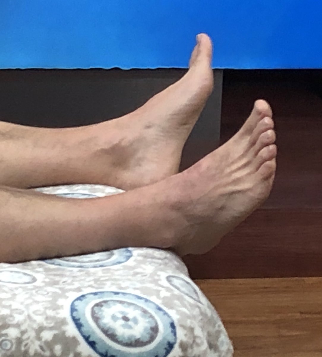 Our <a href="/TuckerFox5/">Tucker Barnes</a> finds out the best sleep positions with <a href="/DrRaySolano/">Dr. Ray Solano</a> . ...the bare feet I can’t explain😂 Only on #Gooddaydc
