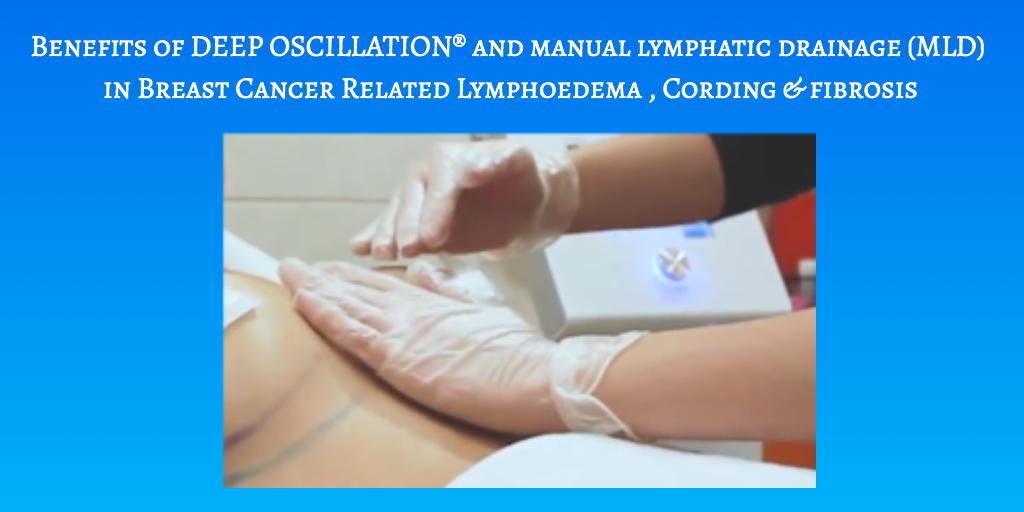 physiopodukltd's tweet photo. Benefits of DEEP OSCILLATION® and manual lymphatic drainage (MLD) in Breast Cancer Related Lymphoedema , Cording & Fibrosis - A Practitioner Review https://t.co/xQF41R9xvw
#BCRL #Cording #Fibrosis #MLD #DEEPOSCILLATION #technologyfortherapy #PhysioPod #physiomed https://t.co/g03swFbW3A