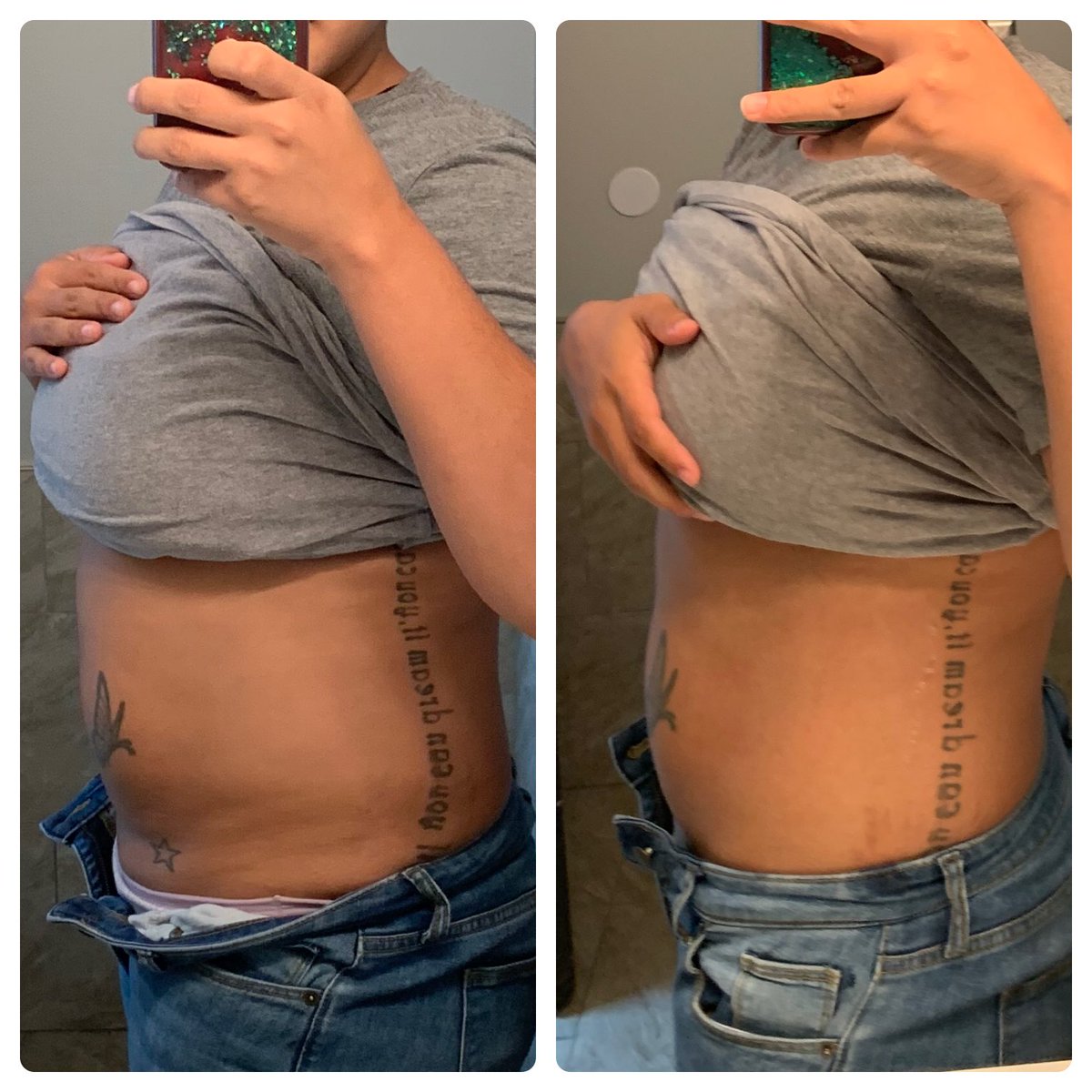 BToxthetics's tweet image. Stubborn fatty areas no problem! #SmartLipo #Kybella #Atl #TGIF BToxthetics💅🏼 tell your friends😎😘🤞🏽