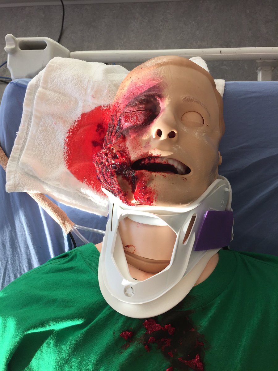_realSimShady's tweet photo. Shout out this amazing facial GSW moulage by @MellowMelKay during the 2016 @OHSUEMRes Trauma Sim Day! I still brag about your skills to this day! 😎 https://t.co/cj2YOo6Xwt