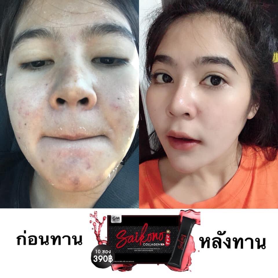 Suraiiz's tweet photo. Saikono collagen
คอลลาเจนนำเข้าจากญี่ปุ่น แถมไม่มีกลิ่นคาว
🍒 ช่วยในเรื่องสิว ผิว ผม เล็บ กระดูก 🍷
ปล. เห็นผลตั้งแต่กล่องแรก 💯 %
ขอแท้แน่นอนค่ะ เป็นตัวแทนค่ะ
ราคา 390 บาทค่าาา
พร้อมส่ง #ไซโคโนะคอลลาเจน #saikonocollagen #saikonocollgen #saikono❤️ #saikonocollagen https://t.co/YioAgpnH63