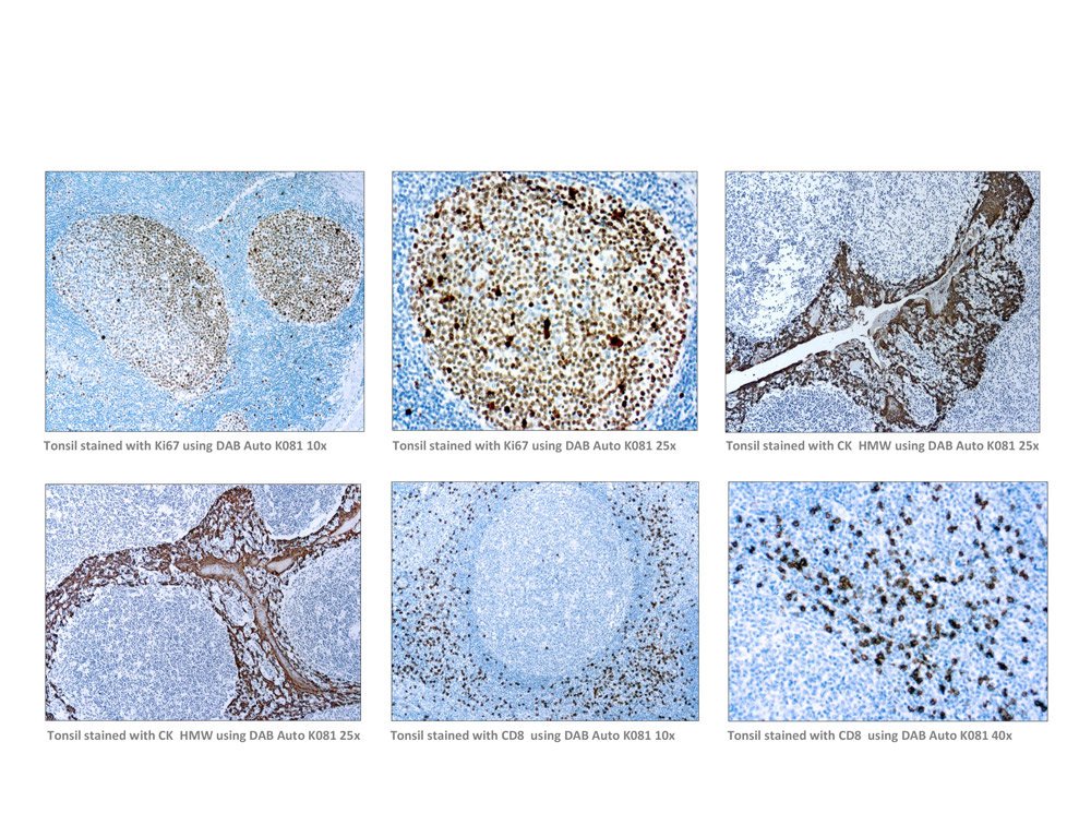 DBS_DxBioSystem's tweet photo. NEW PRODUCT ALERT: DAB-AUTO K081
DAB, a widely used chromogen for immunoperoxidase staining...
Visit Diagnostic BioSystems today to know more:
https://t.co/P4BlVWn9PX
#dab #DBS #chromogenforIHC #IHC #chromogen
#dabauto #K081 https://t.co/o2SSWCxLSJ