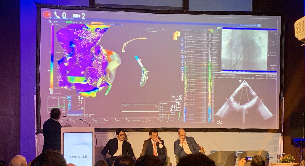 sachinjv's tweet photo. Truly the #DreamTeam #LAHRS2019 @DrFerminGarcia @DrRoderickTung @drcarlosguzmanp using next generation technology in EP. #HDGrid @AbbottCardio @EPeeps_Bot https://t.co/1UvW0Fo1yn