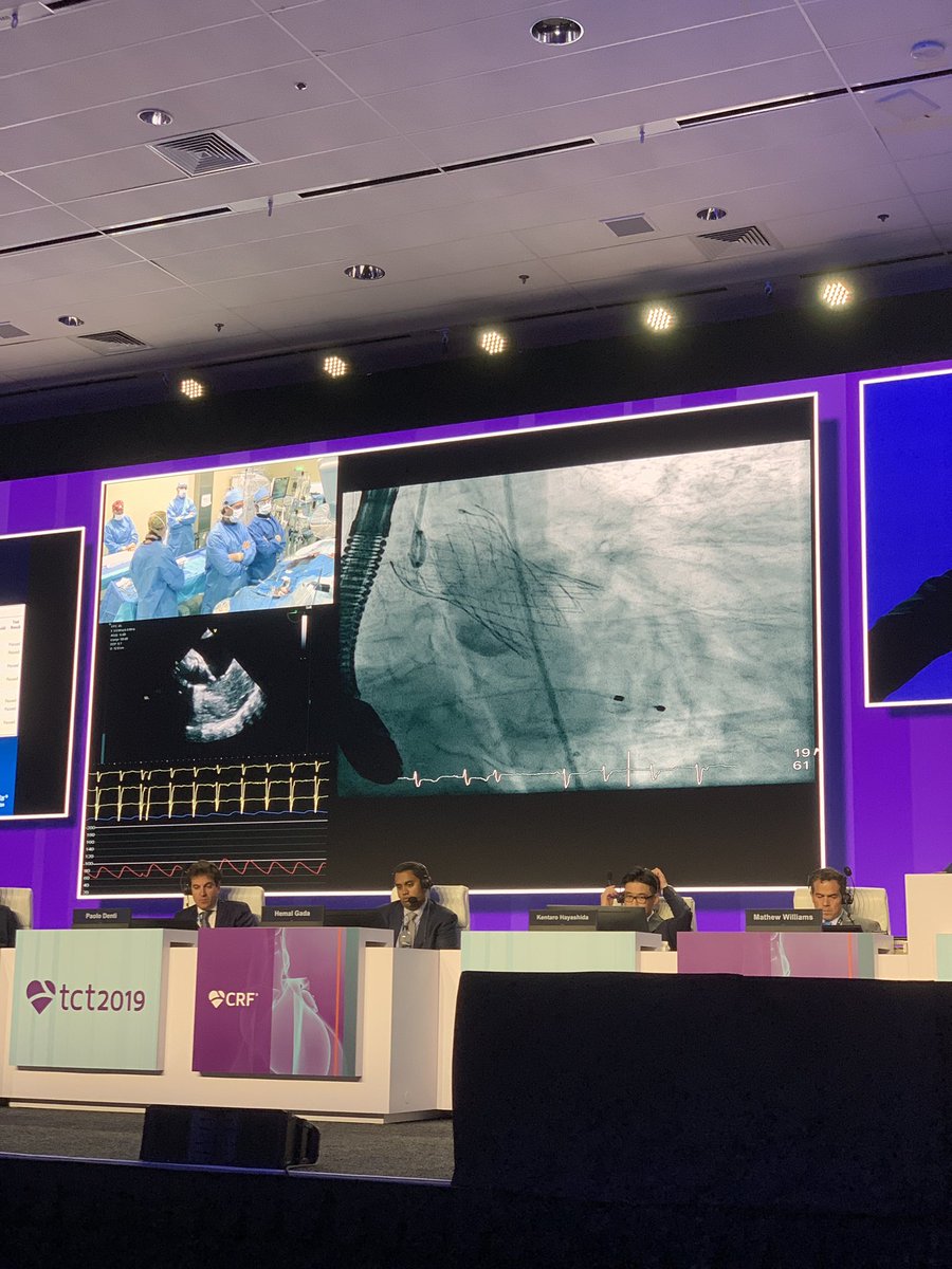 JP Pelletier (@jppelletier3) on Twitter photo <a href="/RinfretStephane/">Stéphane Rinfret, MD SM</a> <a href="/nicolo_piazza/">Nicolo Piazza</a> One case down, one to go. 🇨🇦💪 <a href="/nicolo_piazza/">Nicolo Piazza</a> <a href="/cusm_muhc/">Centre universitaire de santé McGill</a> <a href="/CardioMcgill/">McGillCardioTrainees</a> #TCT2019 <a href="/RinfretStephane/">Stéphane Rinfret, MD SM</a> <a href="/nicolo_piazza/">Nicolo Piazza</a> One case down, one to go. 🇨🇦💪 <a href="/nicolo_piazza/">Nicolo Piazza</a> <a href="/cusm_muhc/">Centre universitaire de santé McGill</a> <a href="/CardioMcgill/">McGillCardioTrainees</a> #TCT2019