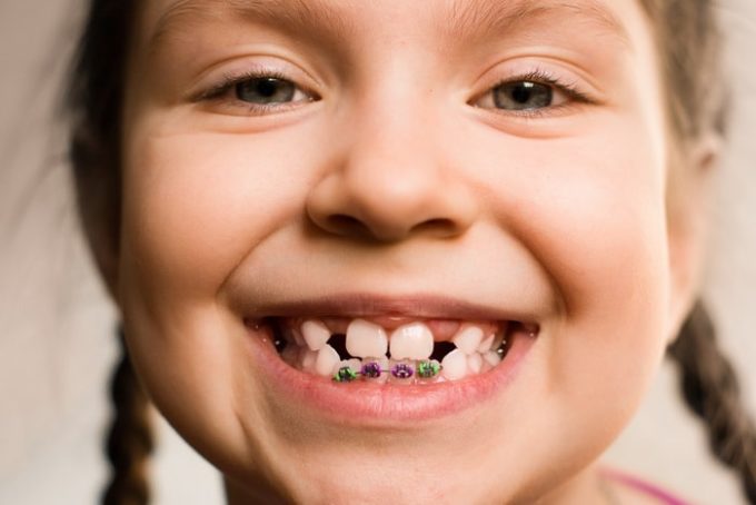 Детский ортодонт томск Удаление зуба ультразвуком Томск Сиреневая