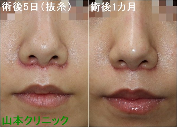 Hashtag 鼻の下が長い Sur Twitter