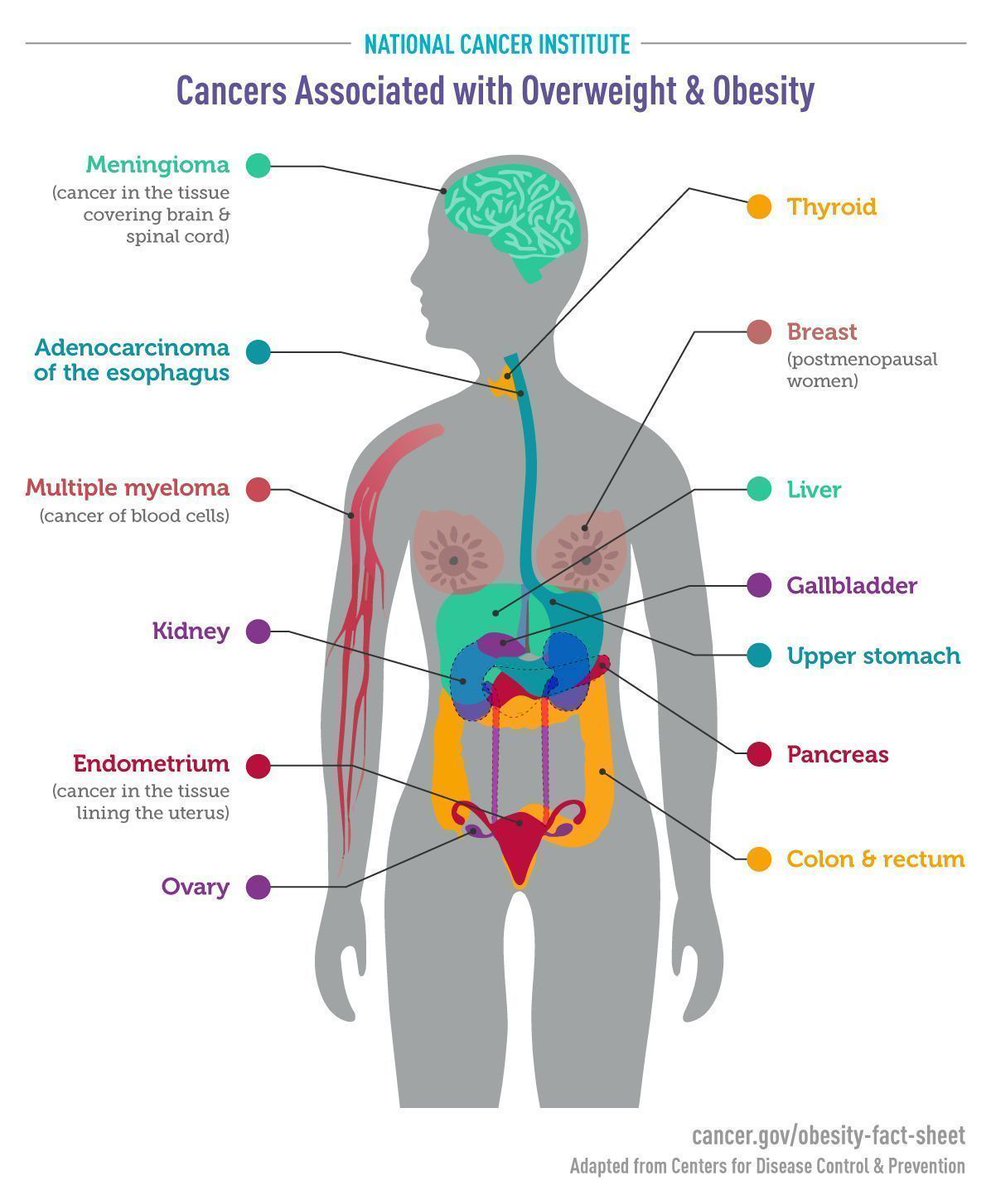 What is known about the relationship between obesity and cancer? Our summary explains: cancer.gov/about-cancer/c…