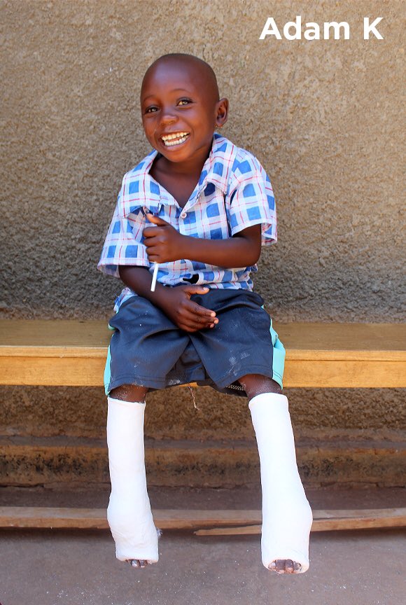 jr_u15's tweet photo. Adam is a young man from Uganda who was born with club feet. This summer the U15 AAA boys supported the 18th Man Program by earning enough money and then some to allow Adam to receive the proper treatment. Very Proud of our boys in helping Adam and his Family. https://t.co/l53hDlcgTy