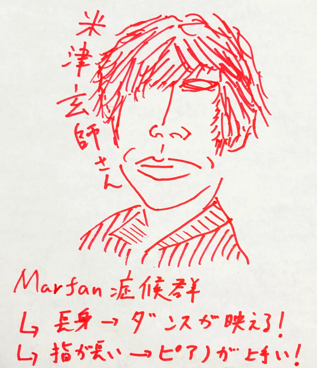 医学語呂なう 米津玄師さんはmarfan症候群 指 手足が長い Thumb Sign Wrist Sign ピアノが上手 ダンスが映える 知能発達正常 医師国家試験113a6で出題 医学語呂なう 米津玄師さんはmarfan症候群 指 手足が長い Thumb Sign Wrist Sign ピアノが上手 ダンスが映える 知能発達正常 医師国家試験113a6で出題