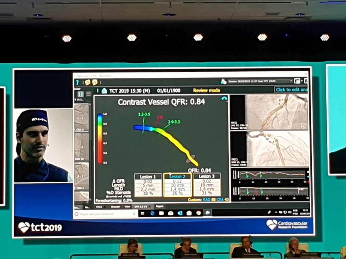 #QFR #TCT2019 
@MedisNL 
Thank you Dante Pazzenese hospital for using our great technology.
No wire, no adenosine, less radiation!