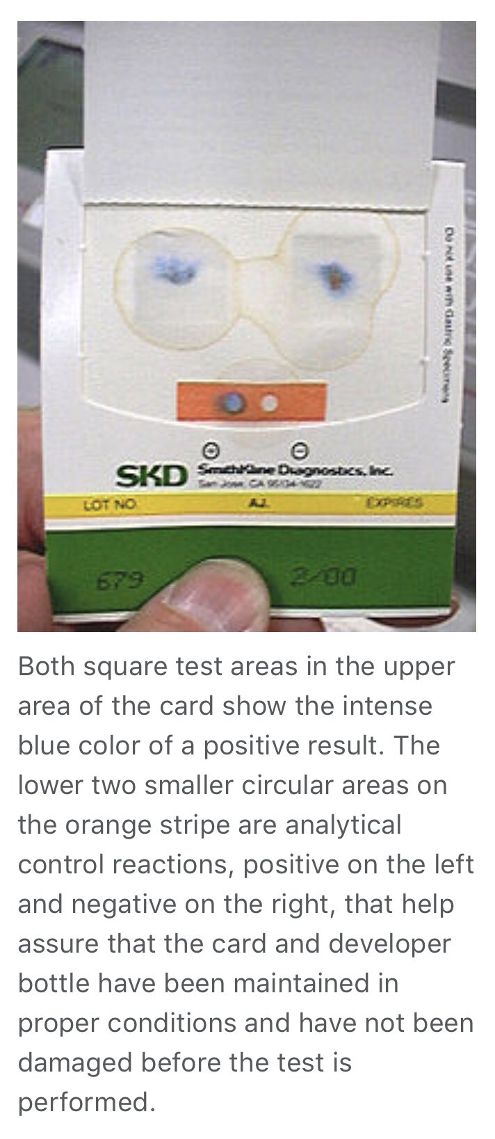 Guaiac Stool Specimen informacionpublica.svet.gob.gt