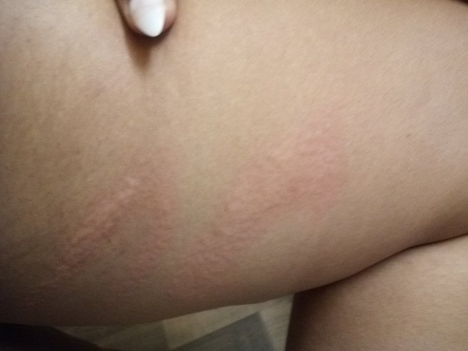 4 for flinching... Discipline,spanks, and a Lollipop for taking it like a good girl 😋🍭 #Canes #lollipop<a href="/tag/denver"class="tags"><span>#denver</span></a><a href="/tag/newyork"class="tags"><span>#newyork</span></a><a href="/tag/lollipop"class="tags"><span>#lollipop</span></a><a href="/tag/lasvegas"class="tags"><span>#lasvegas</span></a><a href="/tag/colorado"class="tags"><span>#colorado</span></a>