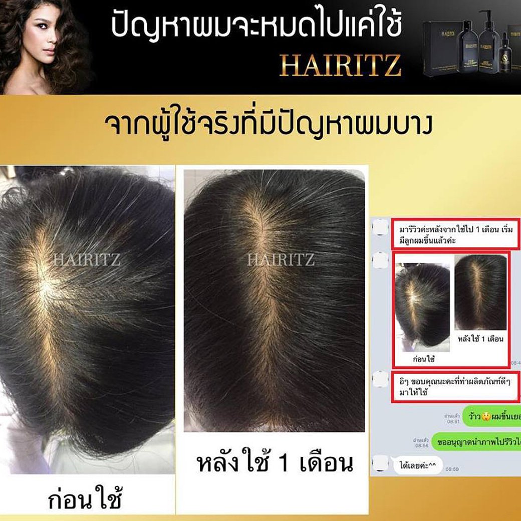 Hairitz1's tweet photo. #ผมร่วงใช้อะไรดี  #Hairitz 
#วิธีแก้ผมร่วง #แชมพูลดผมร่วง
 #ผมบางอยากหาย #หัวล้าน #ผมบาง 
#อยากผมหนา https://t.co/WdhmgYII5n
