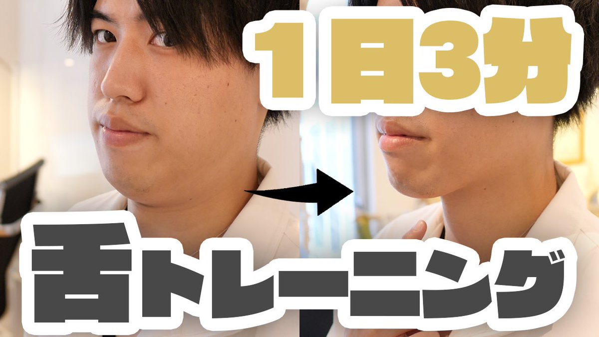 二 重 アゴ 治す