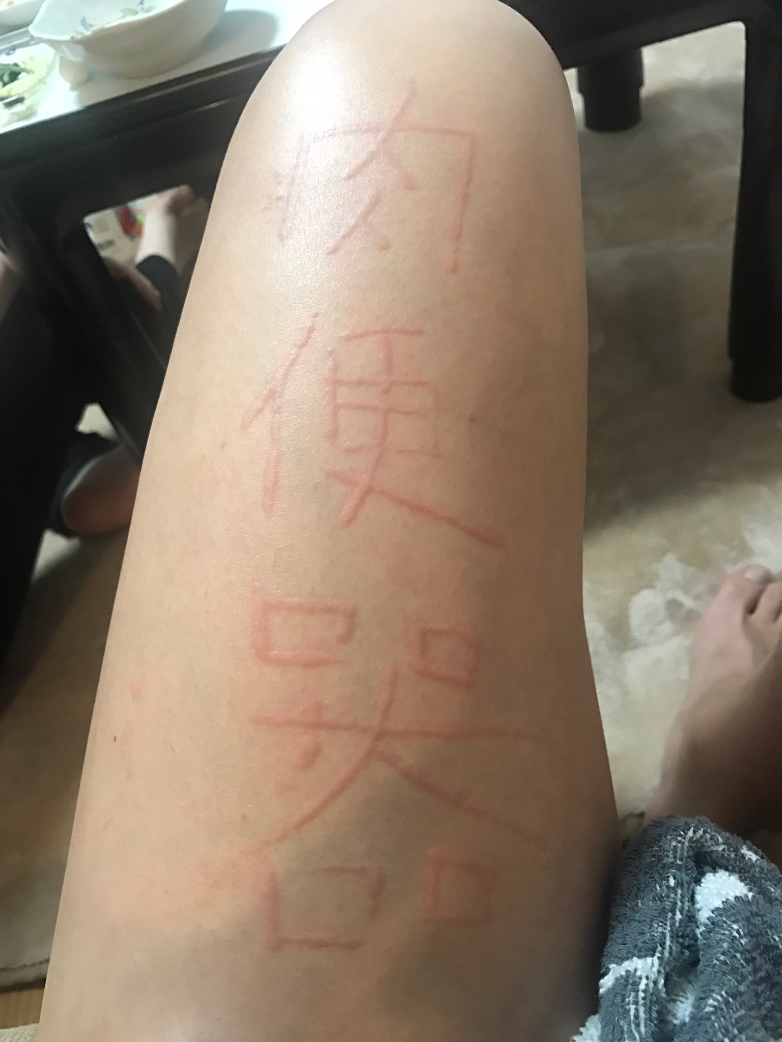 Twitter 上的 ピンクパンティ 爪で引っ掻くと ミミズ腫れんなるからな 第2弾 字を書くと どえらいことになるぞ 太ももに字を書いてみた 肉便器 T Co Cszlfiolhf Twitter Twitter 上的 ピンクパンティ 爪で引っ掻くと ミミズ腫れんなるからな 第2弾 字を書くと どえらいことになるぞ 太ももに字を書いてみた 肉便器 T Co Cszlfiolhf Twitter
