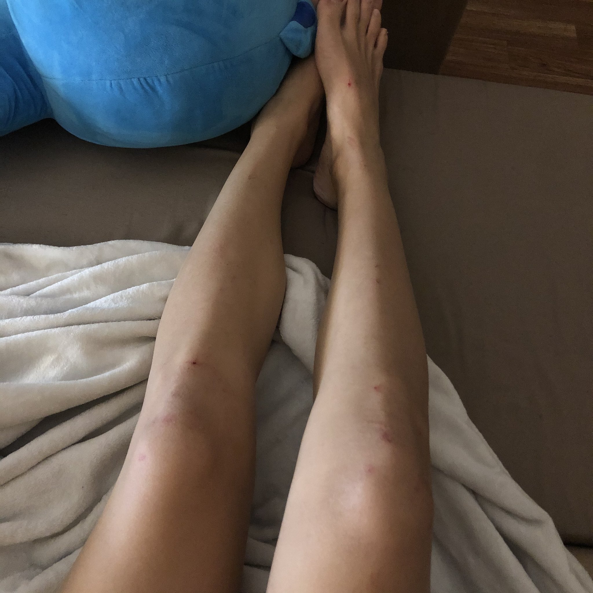 На кровати с бритыми ногами