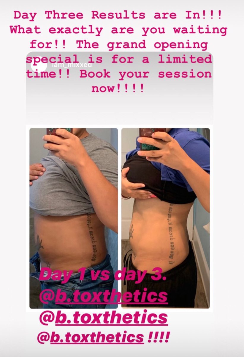 BToxthetics's tweet image. What you waiting for beauties 😍😍😍