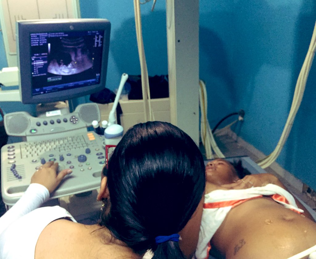 IVSSHLONE's tweet photo. Jornada Médica del @IVSSAVANCESNE @ivssoficial para la comunidad de El Tirano #Antolindelcampo atendiendo a más de 150 niños , 80 adultos y atención Ginecológica y Obstetrica. En conjunto con @MinPesca  @BusMargaritaVE @Dfnsria_Nesprta @FMBANVAESPARTA 
#Trabajandopornuestra🇻🇪 https://t.co/nJEMT1Rv9F