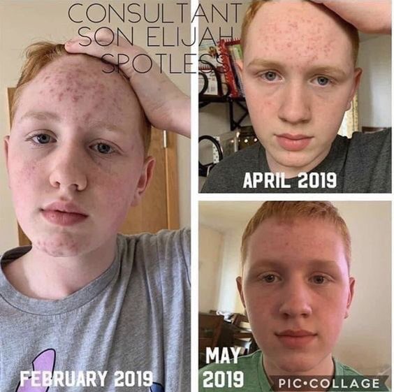 JulieDAlbrecht's tweet photo. Ummm. Time to figure it out. Your skin represents you every day. Don’t skimp on yourself! #skincaresolutionsbyjulie https://t.co/2MBaHEigfC