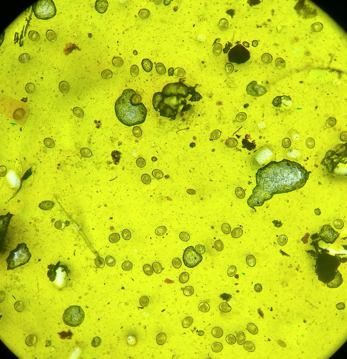 Some microscopic fields of view the #NIMPE team has to deal with while screening children in Northern Vietnam for #STH. Can u spot the #Trichuris egg? The #WHO goal of eliminating morbidity proves difficult to achieve in these remote areas, mainly due to lack of #Sanitation!