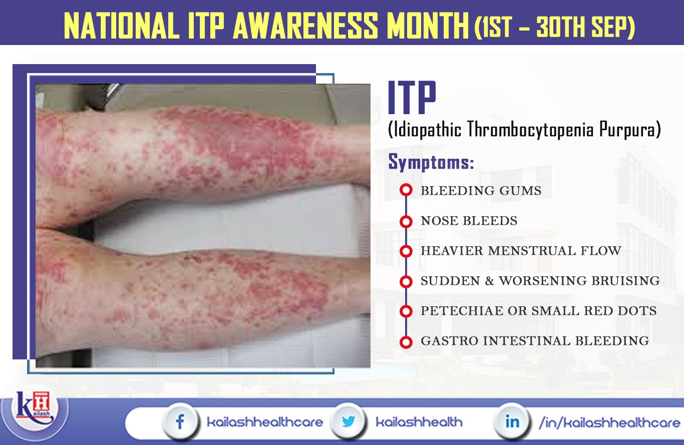 Heparin-Induced Thrombocytopenia | Osmosis