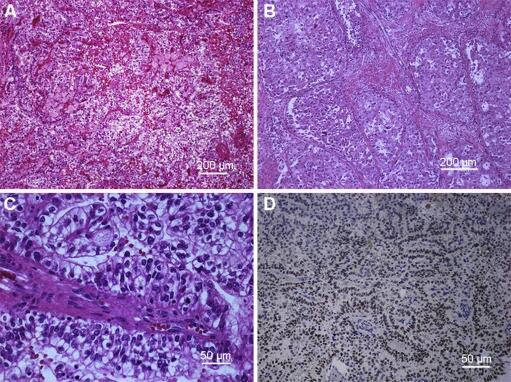 Asian Journal of Urology (@asianjurol) on Twitter photo Microphthalmia family of transcription factors associated renal cell carcinoma
sciencedirect.com/science/articl… Microphthalmia family of transcription factors associated renal cell carcinoma
sciencedirect.com/science/articl…